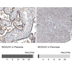 Mucolipin 1 Antibody, Novus Biologicals 0.1mL; Unlabeled:Antibodies, Polyclonal